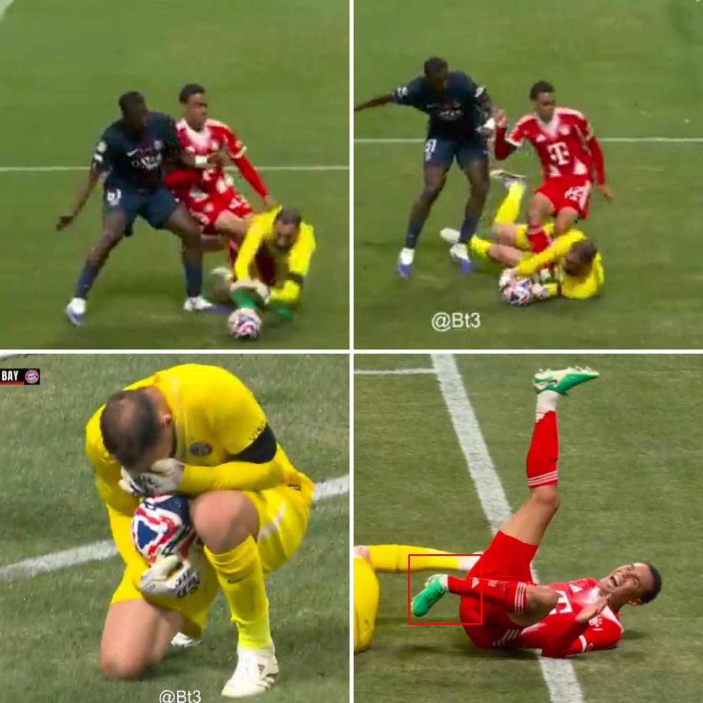 Cầu thủ PSG và Bayern bật khóc khi Jamal Musiala dính chấn thương nặng 1
